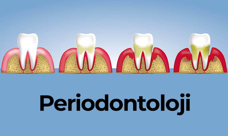 upload/alan2/dental/periodontoloji-nedir.jpg